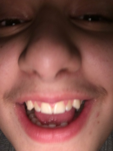 sgfsrefgserfse