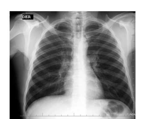 xraykillax
