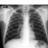 xraykillax